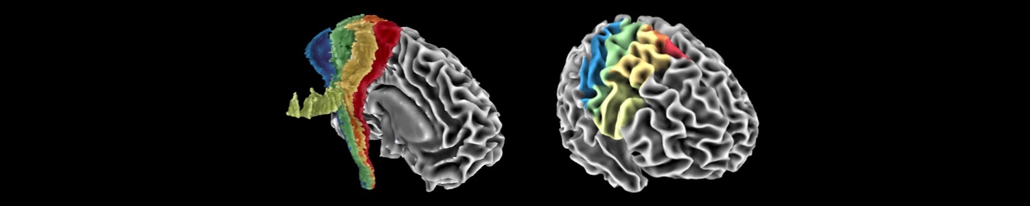 Image of human sensorimotor tracts