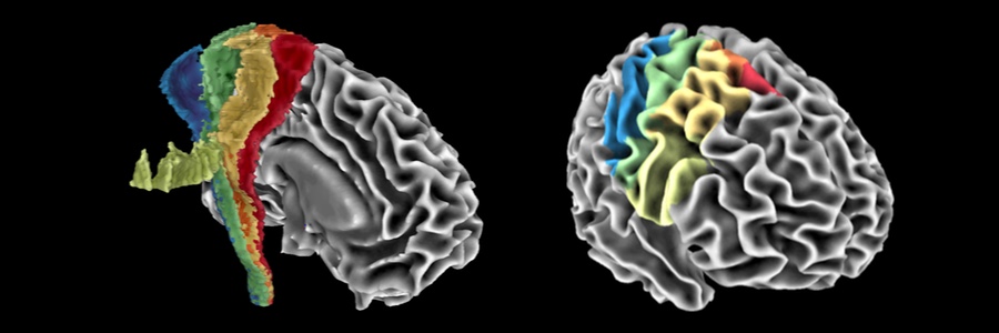 Image of human sensorimotor tracts