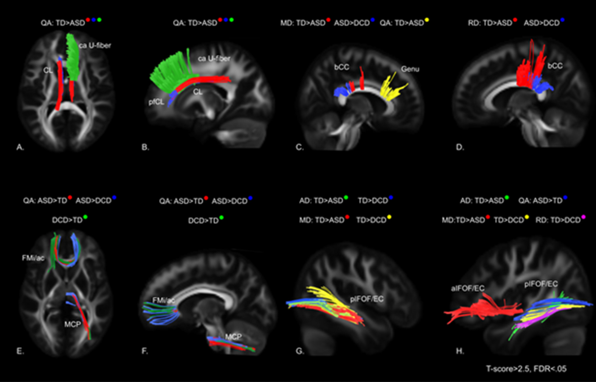 Digital illustration of brain tract maps